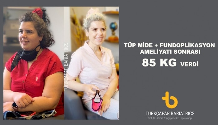 85-kg-verince-1-yil-oncesi-goruntuleri-icin-aradaki-fark-dedi