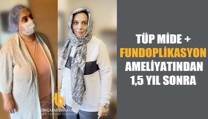 tup-mide-fundoplikasyon-ameliyatindan-1-5-yil-sonra-hem-refluden-kurtuldu-hem-de-30-kg-verdi